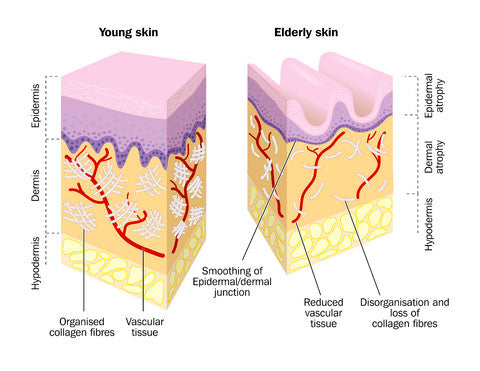 Replacing lost collagen